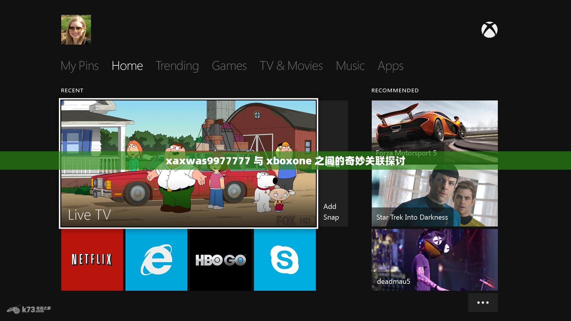 xaxwas9977777 与 xboxone 之间的奇妙关联探讨